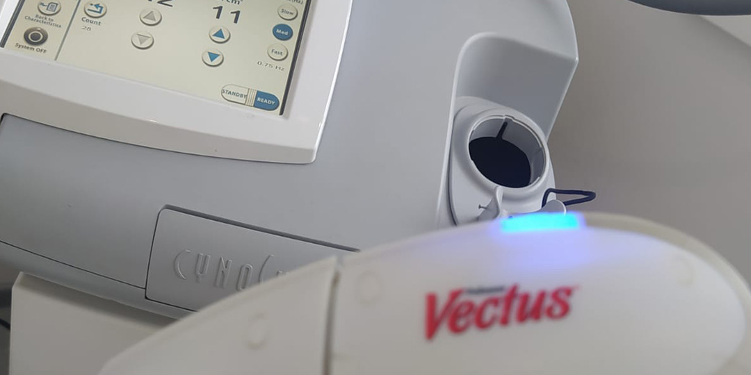 look-ideal-kosmetologia-marta-sorbet-depilacja-laserowa-vectus-01 depilacja laserowa vectus